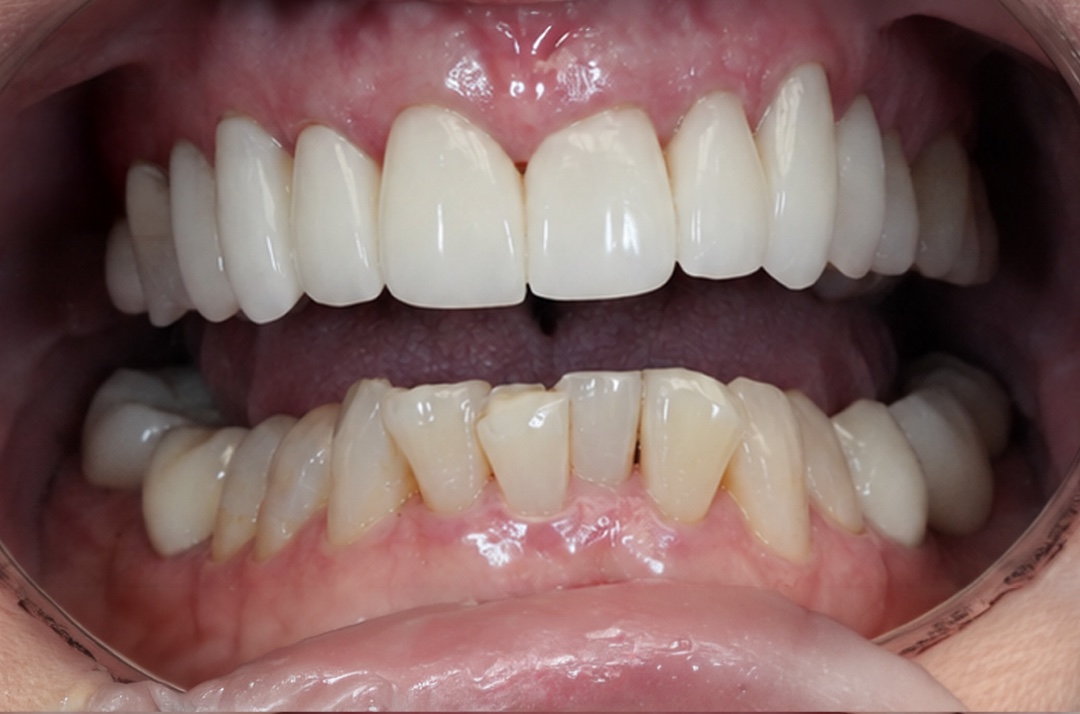 Smile before dental treatment – case 2