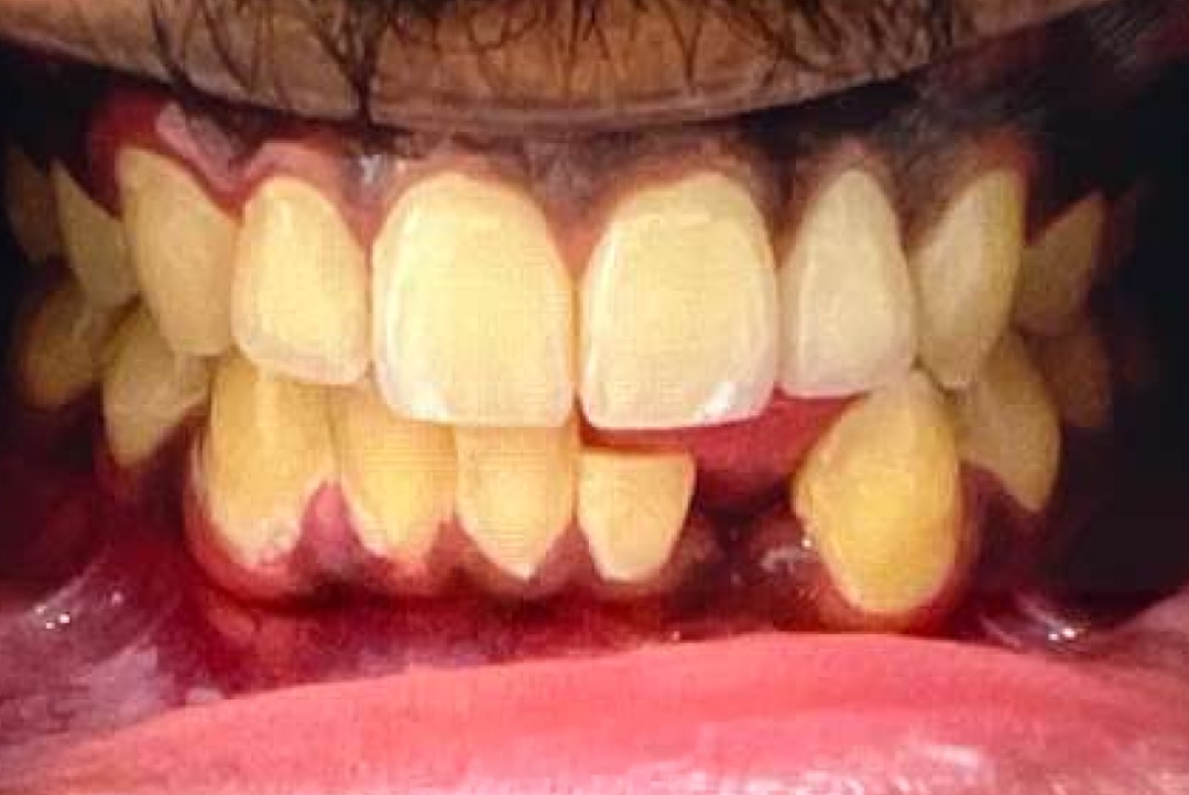 Smile before dental treatment – case 9