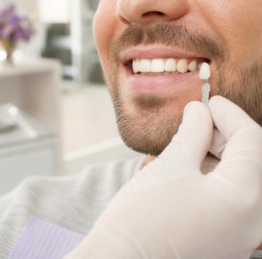 Dentist matching a porcelain crown shade for a patient in Weston